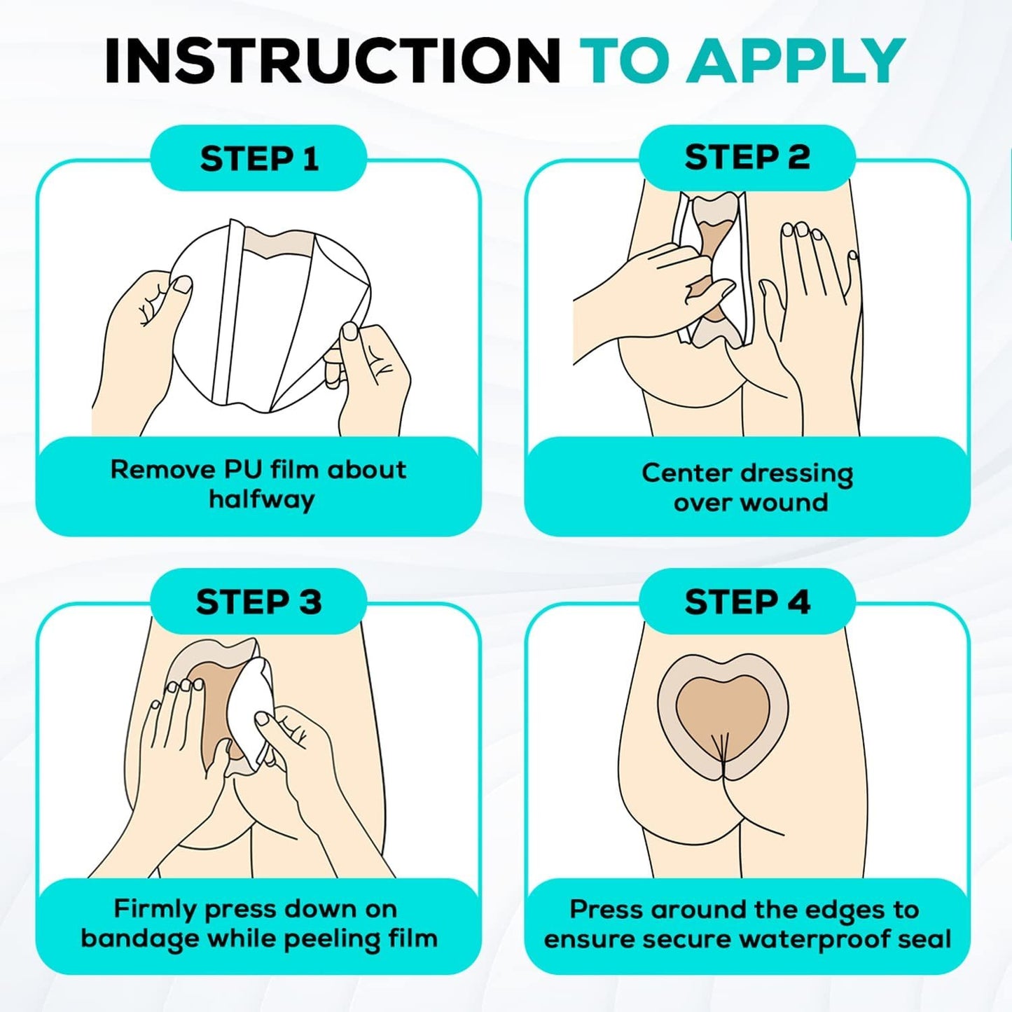 MedVance Silicone Bordered Adhesive Sacral Wound Dressing, 7"x 7", Box of 5